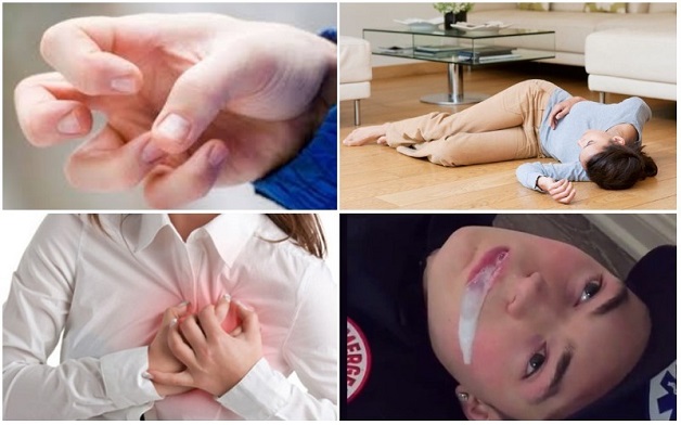 động kinh cục bộ gồm có nhiều dạng