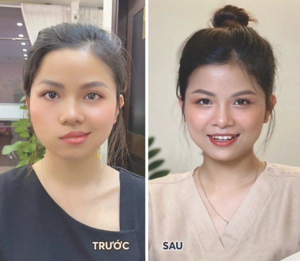 Vì thói quen tắm đêm cô gái trẻ bị viêm dây thần kinh 7