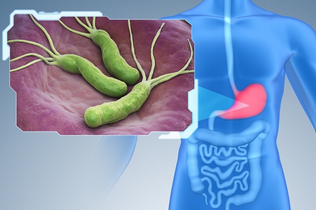 Loét nông dạ dày do virus