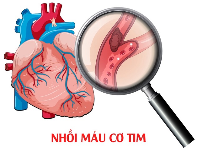 mất ngủ gây ảo giác, bệnh tim mạch