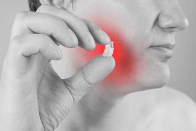 Điều trị thế nào khi răng số 7 bị sâu vỡ?