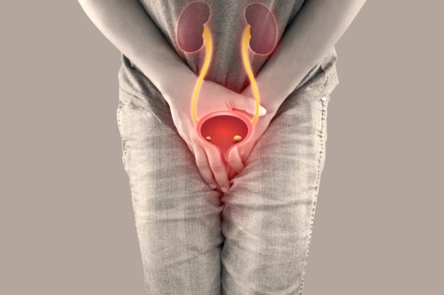 Kỹ thuật nội soi niệu đạo nam để tán sỏi bàng quang