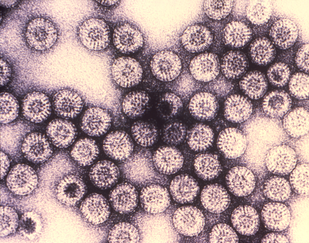 Rotavirus là virus gây tiêu chảy cấp phổ biến nhất ở trẻ nhỏ