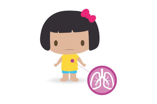 Dị ứng hoặc ảnh hưởng của các bệnh đường hô hấp khiến trẻ dễ mắc hen phế quản
