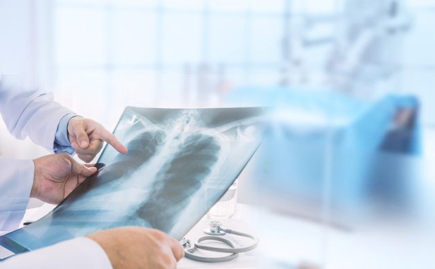 Trẻ bị viêm đường hô hấp trên có thể sẽ bị biến chứng viêm phổi