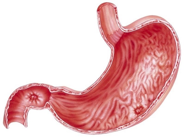 Viêm loét dạ dày là bệnh lý phổ biến ở hệ tiêu hóa