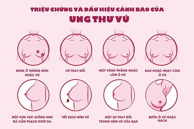 dấu hiệu ung thư vú