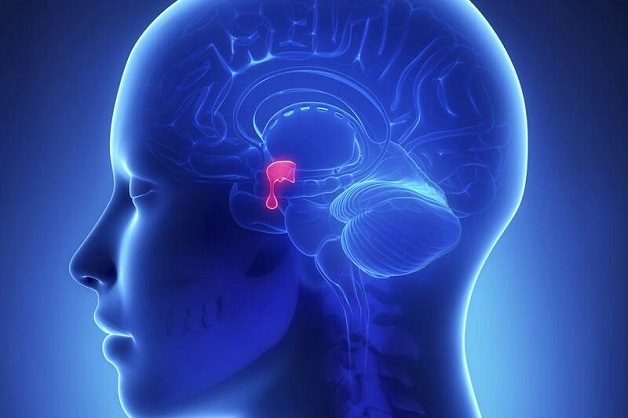 Đau nửa đầu thường xuyên coi chừng u tuyến yên, đột quỵ tuyến yên