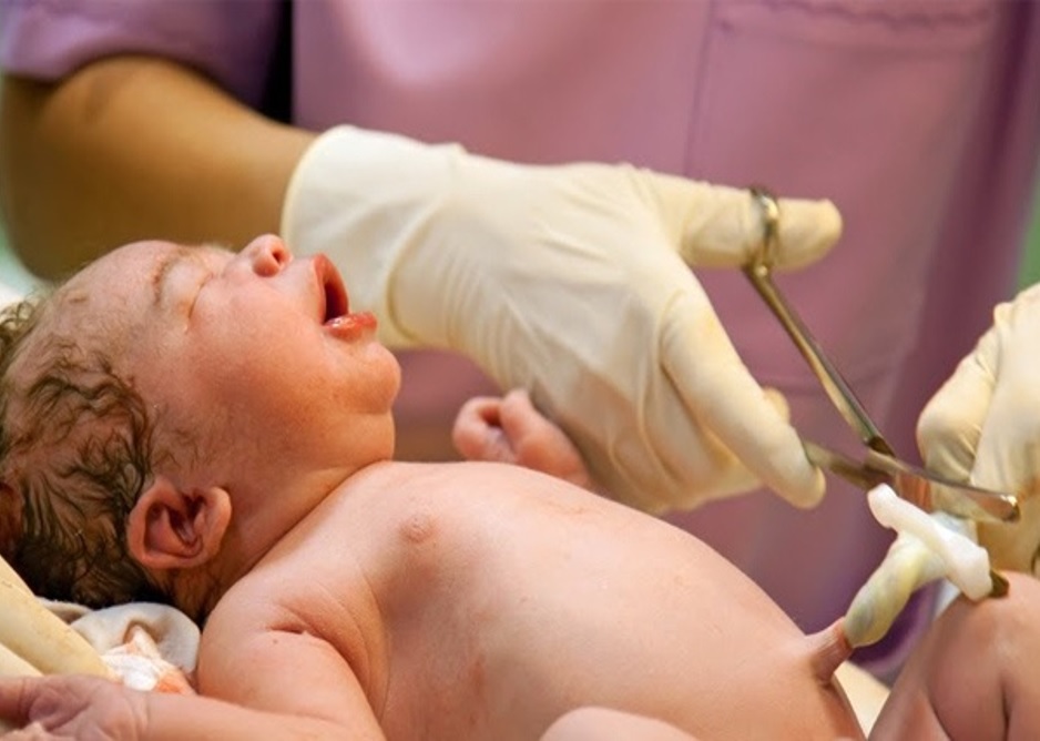 Uốn ván rốn sơ sinh - Căn bệnh nguy hiểm đe dọa tính mạng của trẻ sơ sinh