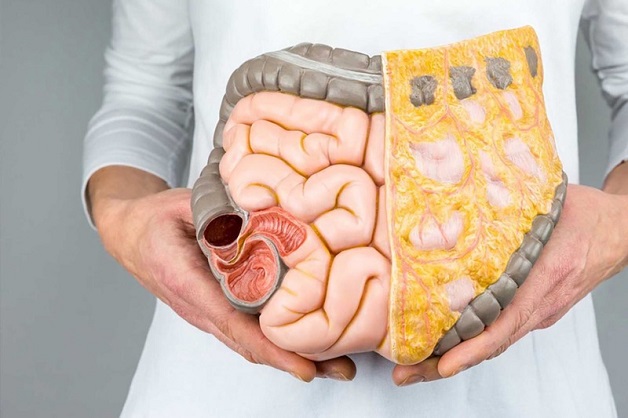 TRiệu chứng Viêm đại tràng co thắt mạn tính
