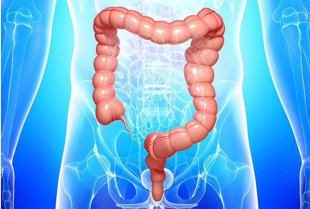 Viêm niêm mạc đại tràng là gì
