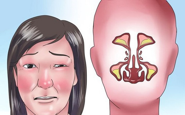 tầm soát ung thư vòm họng bằng cách nào