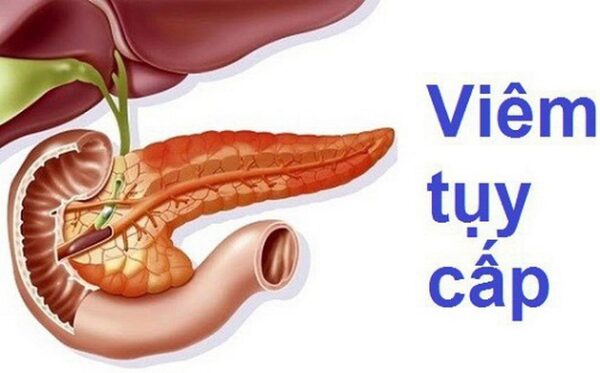 Triệu chứng lâm sàng viêm tụy cấp như thế nào?