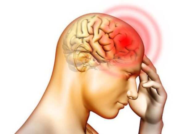 Đau nửa đầu trên là bệnh lý ngày càng phổ biến, gây ảnh hưởng không nhỏ đến quá trình làm việc