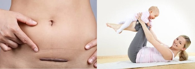 Đáp án cho câu hỏi