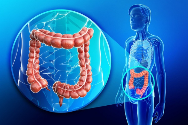 Cần cảnh giác căn bệnh ung thư trực tràng và thực hiện tầm soát ung thư trực tràng sớm nhất có thể