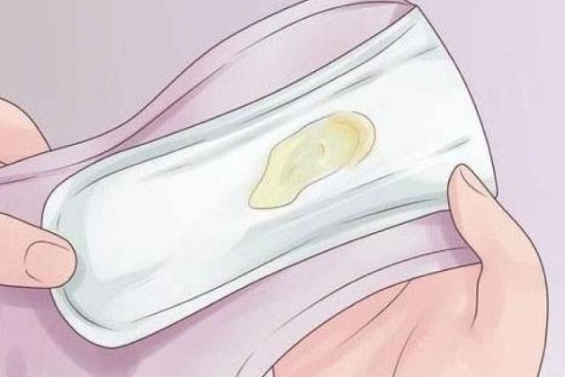 biểu hiện viêm nhiễm phụ khoa