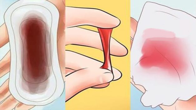 khi nào cần tầm soát ung thư cổ tử cung: khi có những dấu hiệu sau
