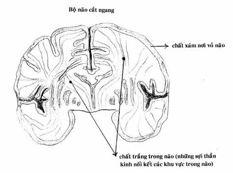 Mất ngủ kéo dài do thoái hóa não chất trắng