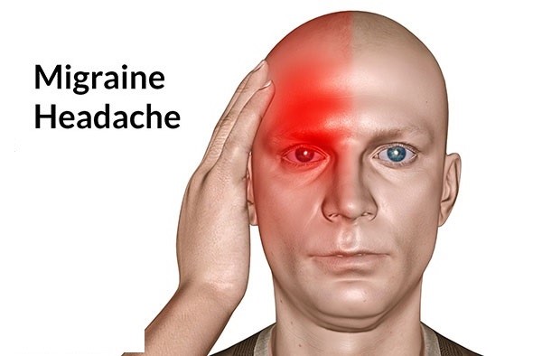 Migraine - đau nửa đầu cách điều trị