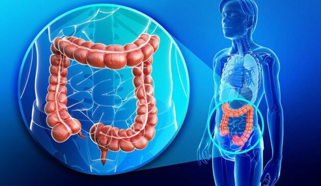 Ung thư đại trwucj tràng là căn bệnh nguy hiểm