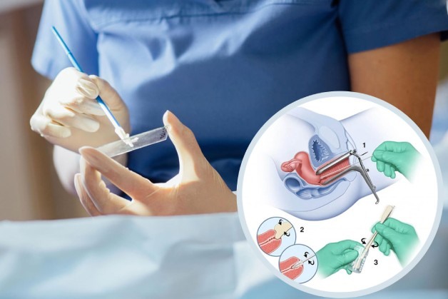 Phương pháp sàng lọc ung thư cổ tử cung