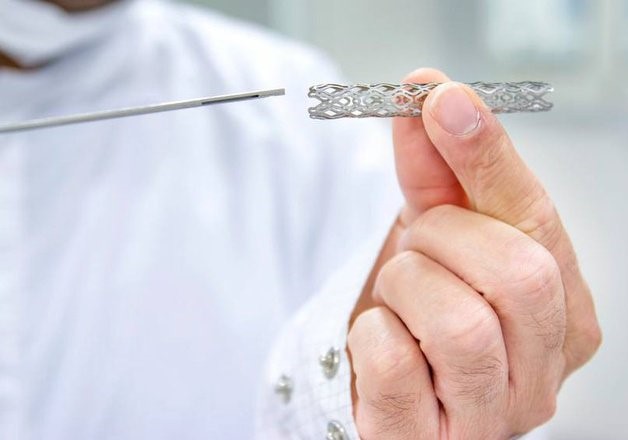 Nhồi máu cơ tim điều trị bằng đặt stent