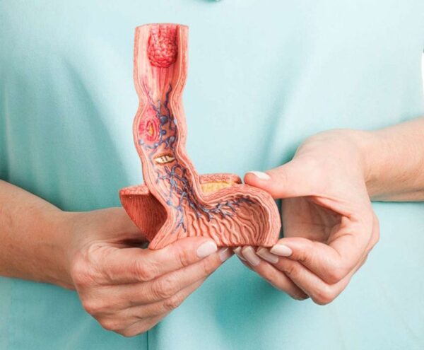 giải đáp ung thư thực quản sống được trong bao lâu
