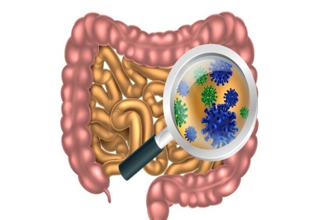 Viêm ruột non do vi sinh vật gây bệnh (như Salmonella, Shigella, E. coli
