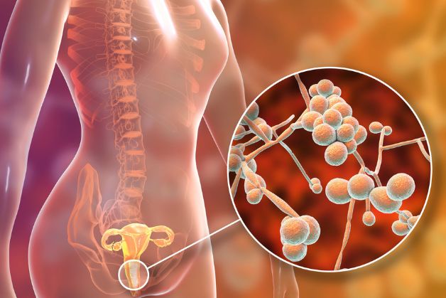 các triệu chứng của viêm âm đạo không thể bỏ qua