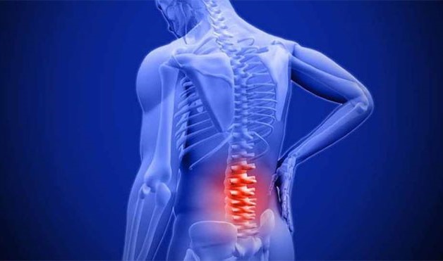 Thoái hóa đốt sống lưng được đánh giá là một bệnh lý mãn tính
