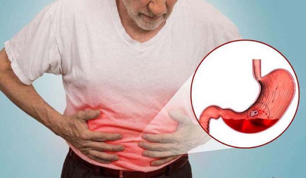 Đau bụng trào ngược dạ dày có thể gây ra nhũng biến chứng nguy hiểm