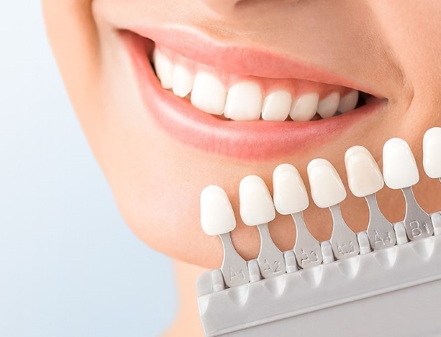 Dán sứ Veneer Ultrathin