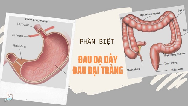 Đau dạ dày và đại tràng là hai bệnh khác nhau ở hệ tiêu hóa
