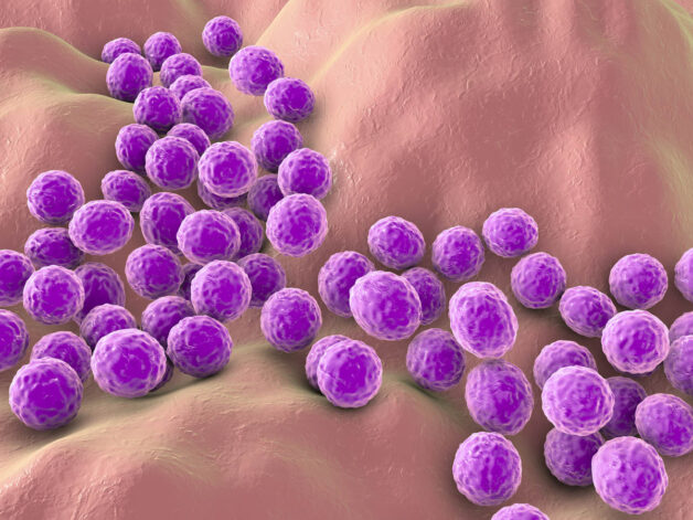 Tụ cầu khuẩn Staphylococcus aureus gây đau mắt đỏ.