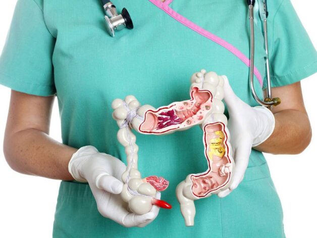 Tổng hợp thông tin hóa trị ung thư đại tràng