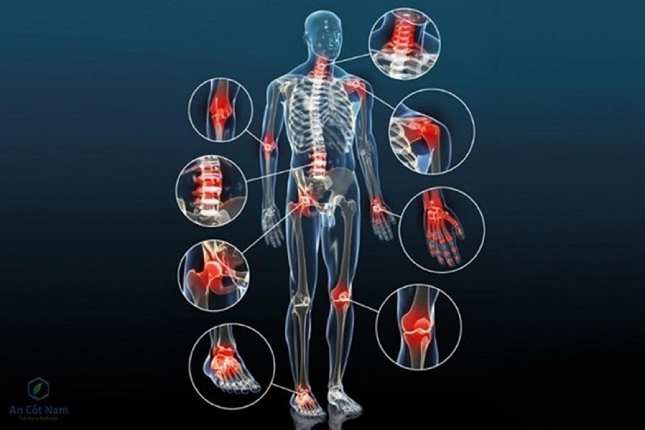 Sức khỏe xương khớp và hệ thần kinh có mối liên hệ vô cùng chặt chẽ trong cơ thể người