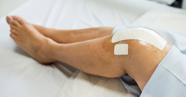 thoái hóa khớp gối cách điều trị dùng thuốc