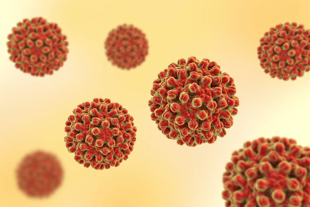 Viêm gan B có nguyên nhân khởi phát là virus viêm gan B (virus HBV)