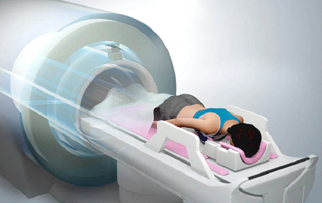 chụp mri vú