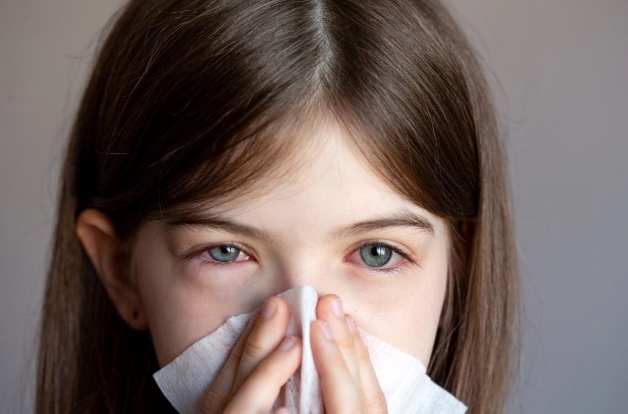 viêm kết giác mạc dị ứng điều trị
