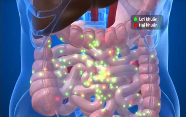 Tác động của vi khuẩn thường trú gây ra bệnh Crohn dẫn đến triệu chứng đau ruột già