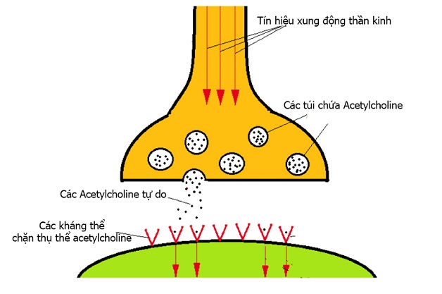 cơ chế gây bệnh rối loạn thần kinh cơ