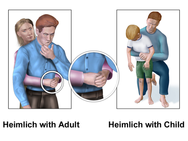 Cách chữa hóc xương cá 4