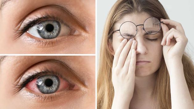 Những tác hại khi đeo kính cận lệch tâm