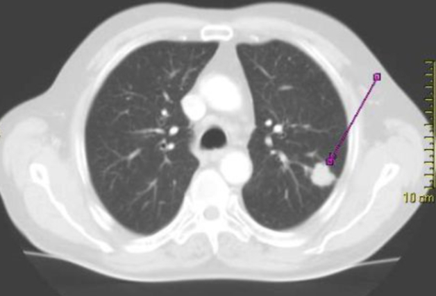 hình ảnh chụp MRI