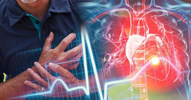 đột quỵ nguyên nhân do tim có biểu hiện như thế nào?