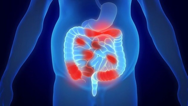 Hoại tử ruột là bệnh lý vô cùng nguy hiểm có thể gặp ở cả trẻ sơ sinh