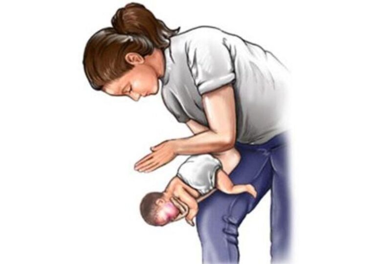 hóc dị vật đường thở ở trẻ