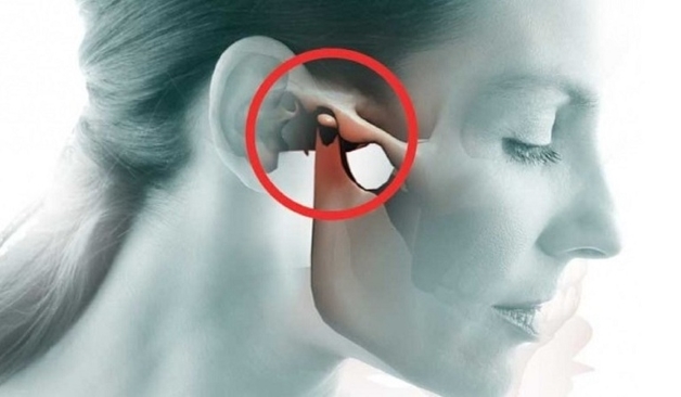 khớp cắn kêu khi há miệng